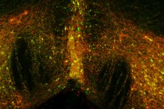 LM04
Phoenix

microscope: Olympus BX60 Fluorescence microscope
description: TH and DsRed double staining in brain slices of rats treated with DREADD technology 
Author: Judith Hendriks
