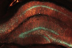 LM06
Knockin’ in memories

microscope: Zeiss LSM700
description: CRISPR knock-in for PSD95, in the hippocampal formation of mouse brain
Author: Arthur Jong
