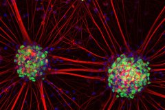 LM09
Neuronal sunflowers

microscope: Confocal microscope LSM 880.
description: Motor neurons were derived from human induced pluripotent stem cells and stained with neuronal markers
Author: Svetlana Pasteuning-Vuhman 

