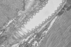 EM01
Air waves

microscope: JEOL 1011 electron microscope
description: EM image of a part of a tracheole, a branch of the insect airway system, between the circular and longitudinal muscle cell layers of the Drosophila intestinal wall
Author: Ann De Mazière 
