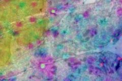 EM05
Cells and staining in Las Vegas

microscope: Tecnai 12 / DeltaVision widefield microscope
description: It occurred in some photoshop experimentation to find the best way of overlaying Fluorescence and EM images, it's an inverted color set. While not very informative, it makes a very colorful image. It reminded me of the many colorful lights in Las Vegas. The EM picture is a stitch made with serial EM software on a Tecnai 12, the fluorescence is from a DeltaVision widefield microscope. I'd like to place it in the category 'Electron microscopy' images of the competition
Author: Jan van der Beek 
