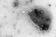 EM06
The excessive cruelty of antibiotics on bacteria

microscope: Tecnai T12
description: A new antibiotic compound appears to rip apart the bacterial cell wall and leave only the mutilated bacterial remains behind... No survivors were found in this sample
Author: Marco Viveen
